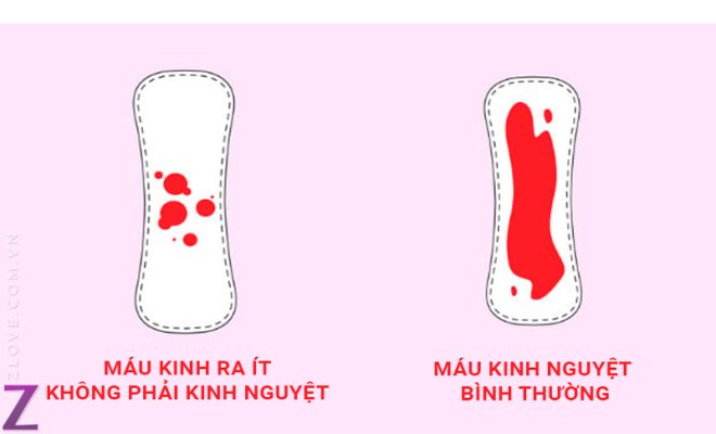 Kinh nguyệt ra ít có sao không